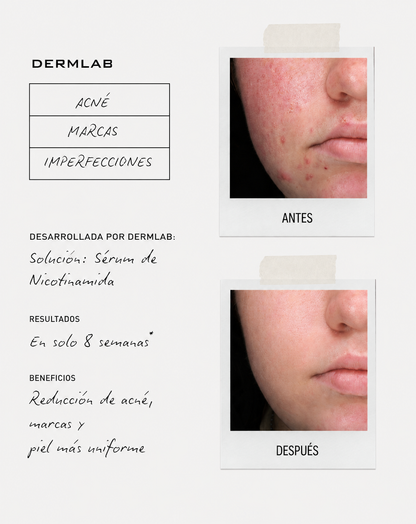 DermLab - 2x1 Nicotinamide Serum